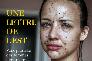 Photo de gros plan d'une jeune femme avec des taches sur le visage
